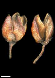 Veronica truncatula. Capsules. Scale = 1 mm.
 Image: W.M. Malcolm © Te Papa CC-BY-NC 3.0 NZ